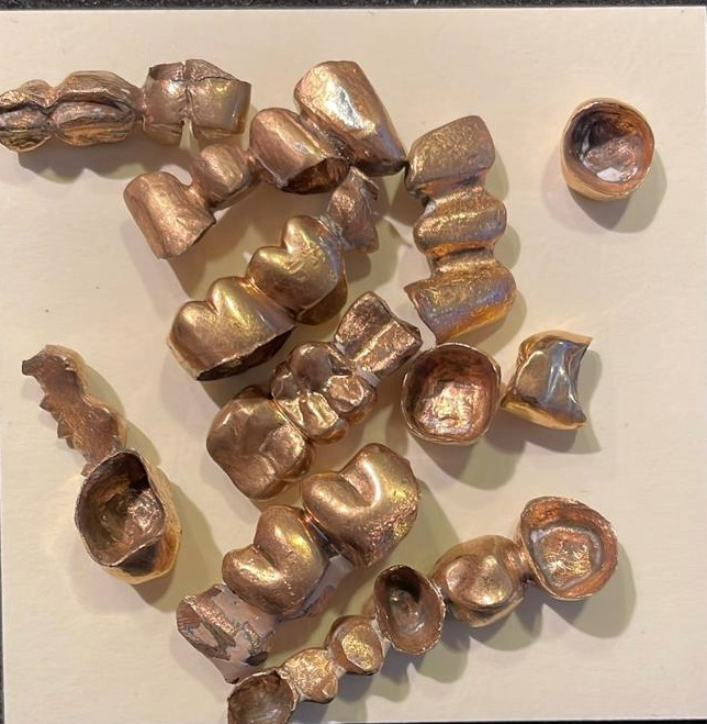 Gold-plated chromium-cobalt as dental gold